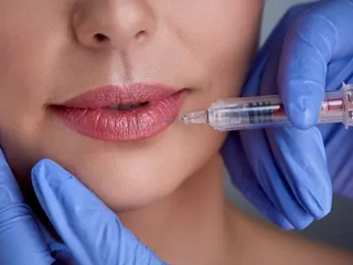 convenios-grupo-lider-plan-botox